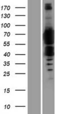 Western Blot: FTO Overexpression Lysate (Adult Normal) [NBP2-08494] Left-Empty vector transfected control cell lysate (HEK293 cell lysate); Right -Over-expression Lysate for FTO.