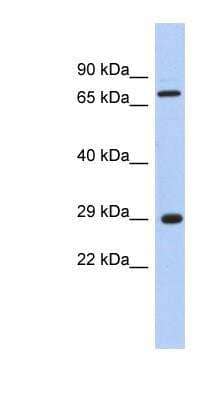 Western Blot: FTS Antibody [NBP1-53106] - Titration: 0.2-1 ug/ml, Positive Control: Human Muscle.
