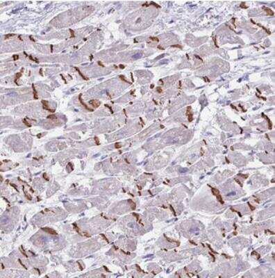 Immunohistochemistry: FTSJ2 Antibody [NBP2-30601] - Staining of human heart muscle shows strong membranous positivity in myocytes/ Intercalated disc distinctly stained.