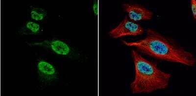 Immunocytochemistry/Immunofluorescence: FUBP1 Antibody [NBP2-16543] - HeLa cells were fixed in 4% paraformaldehyde at RT for 15 min. Green: FUBP1 protein stained by FUBP1 antibody diluted at 1:1000. Red: alpha Tubulin, a cytoskeleton marker, stained by alpha Tubulin antibody [B-5-1-diluted at 1:10000. Blue: Hoechst 33342 staining.