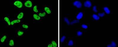 Immunocytochemistry/Immunofluorescence: FUBP1 Antibody (SY11-04) [NBP2-67386] - Staining FUBP1 in Hela cells (green). The nuclear counter stain is DAPI (blue). Cells were fixed in paraformaldehyde, permeabilised with 0.25% Triton X100/PBS.