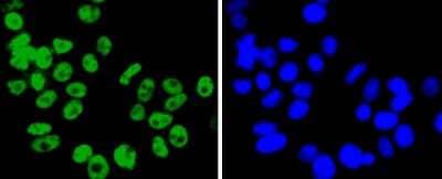 Immunocytochemistry/Immunofluorescence: FUBP1 Antibody (SY11-04) [NBP2-67386] - Staining FUBP1 in MCF-7 cells (green). The nuclear counter stain is DAPI (blue). Cells were fixed in paraformaldehyde, permeabilised with 0.25% Triton X100/PBS.