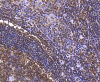 Immunohistochemistry-Paraffin: FUBP1 Antibody (SY11-04) [NBP2-67386] - Analysis of paraffin-embedded human tonsil tissue using anti-FUBP1 antibody. Counter stained with hematoxylin.