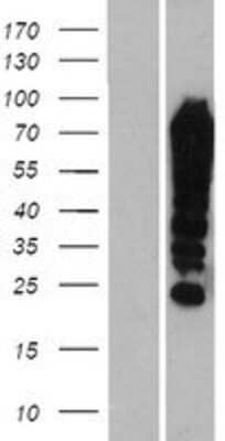 Western Blot FUBP1 Overexpression Lysate