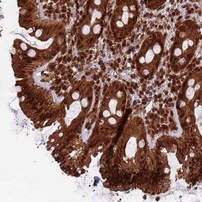 Immunohistochemistry-Paraffin FUBP3 Antibody - BSA Free