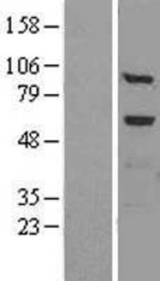 Western Blot: FUCA1 Overexpression Lysate (Adult Normal) [NBL1-10855] Left-Empty vector transfected control cell lysate (HEK293 cell lysate); Right -Over-expression Lysate for FUCA1.