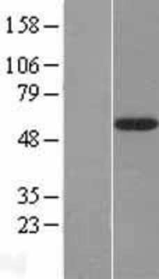 Western Blot: FUCA2 Overexpression Lysate (Adult Normal) [NBL1-10856] Left-Empty vector transfected control cell lysate (HEK293 cell lysate); Right -Over-expression Lysate for FUCA2.