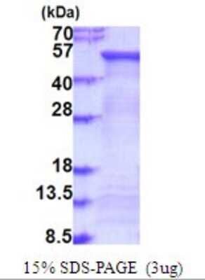 SDS-Page: FUCA2 Recombinant Protein [NBP2-51910] - 15% SDS Page (3 ug)