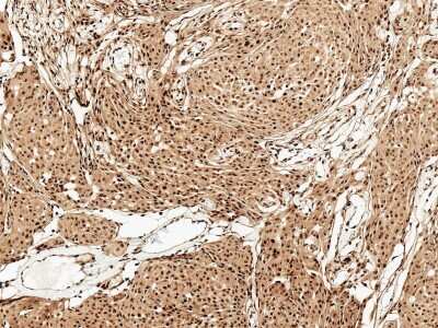 Immunohistochemistry: FUNDC1 Antibody [NBP3-18250] - Immunohistochemistry analysis using Rabbit Anti-FUNDC1 Polyclonal Antibody (NBP3-18250). Tissue: Brain. Species: Human. Fixation: Formalin Fixed Paraffin-Embedded. Primary Antibody: Rabbit Anti-FUNDC1 Polyclonal Antibody (NBP3-18250) at 1:50 for 30 min at RT. Counterstain: Hematoxylin. Magnification: 10X. HRP-DAB Detection.