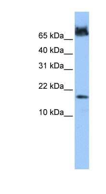 Western Blot: FUNDC1 Antibody [NBP1-55388] - Human Heart lysate, concentration 0.2-1 ug/ml.