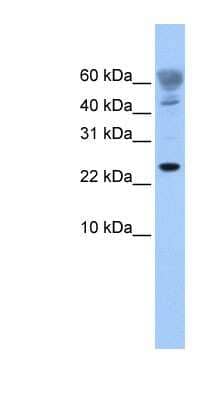 Western Blot: FUNDC1 Antibody [NBP1-56430] - 721_B cell lysate, concentration 0.2-1 ug/ml.