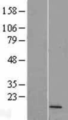 Western Blot: FUNDC2P2 Overexpression Lysate (Adult Normal) [NBL1-12598] Left-Empty vector transfected control cell lysate (HEK293 cell lysate); Right -Over-expression Lysate for FUNDC2P2.