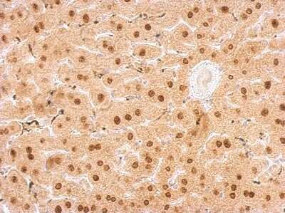 Immunohistochemistry-Paraffin: FUR1 Antibody [NBP2-16547] - UPRT antibody detects UPRT protein at cytosol and nucleus on mouse liver by immunohistochemical analysis. Sample: Paraffin-embedded mouse liver. UPRT antibody dilution: 1:500.