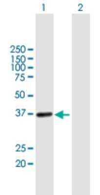 Western Blot: FUR1 Antibody [H00139596-B01P] - Analysis of UPRT expression in transfected 293T cell line by UPRT polyclonal antibody.  Lane 1: RP11-311P8.3 transfected lysate(33.99 KDa). Lane 2: Non-transfected lysate.