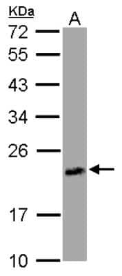 Western Blot: FUR1 Antibody [NBP2-16547] - Sample (30 ug of whole cell lysate) A: A549 12% SDS PAGE gel, diluted at 1:500.