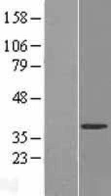 Western Blot: FUR1 Overexpression Lysate (Adult Normal) [NBL1-17627] Left-Empty vector transfected control cell lysate (HEK293 cell lysate); Right -Over-expression Lysate for FUR1.