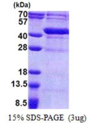 SDS-Page: FUR1 Protein [NBP2-22933]