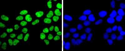 Immunocytochemistry/Immunofluorescence: FUS Antibody (JJ09-31) [NBP2-67913] - Staining FUS/TLS in Hela cells (green). The nuclear counter stain is DAPI (blue). Cells were fixed in paraformaldehyde, permeabilised with 0.25% Triton X100/PBS.