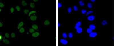 Immunocytochemistry/Immunofluorescence: FUS Antibody (JJ09-31) [NBP2-67913] - Staining FUS/TLS in MCF-7 cells (green). The nuclear counter stain is DAPI (blue). Cells were fixed in paraformaldehyde, permeabilised with 0.25% Triton X100/PBS.