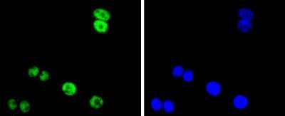 Immunocytochemistry/Immunofluorescence: FUS Antibody (JJ09-31) [NBP2-67913] - Staining FUS/TLS in SW480 cells (green). The nuclear counter stain is DAPI (blue). Cells were fixed in paraformaldehyde, permeabilised with 0.25% Triton X100/PBS.