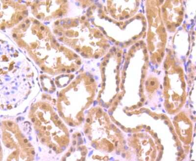 Immunohistochemistry-Paraffin: FUS Antibody (JJ09-31) [NBP2-67913] - Analysis of paraffin-embedded human kidney tissue using anti-FUS/TLS antibody. Counter stained with hematoxylin.