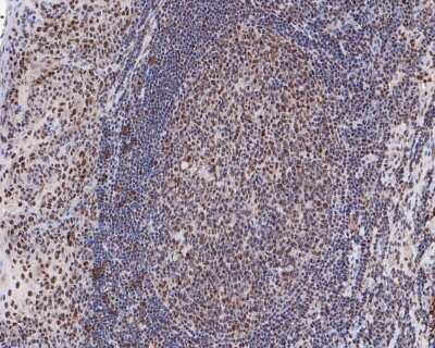 Immunohistochemistry-Paraffin: FUS Antibody (JJ09-31) [NBP2-67913] - Immunohistochemical analysis of paraffin-embedded human tonsil tissue using anti-FUS antibody. The section was pre-treated using heat mediated antigen retrieval with sodium citrate buffer (pH 6.0) for 20 minutes. The tissues were blocked in 5% BSA for 30 minutes at room temperature, washed with ddH2O and PBS, and then probed with the primary antibody (1/50) for 30 minutes at room temperature. The detection was performed using an HRP conjugated compact polymer system. DAB was used as the chromogen. Tissues were counterstained with hematoxylin and mounted with DPX.