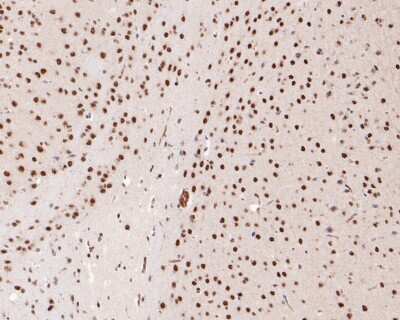 Immunohistochemistry-Paraffin: FUS Antibody (JJ09-31) [NBP2-67913] - Immunohistochemical analysis of paraffin-embedded mouse brain tissue using anti-FUS antibody. The section was pre-treated using heat mediated antigen retrieval with sodium citrate buffer (pH 6.0) for 20 minutes. The tissues were blocked in 5% BSA for 30 minutes at room temperature, washed with ddH2O and PBS, and then probed with the primary antibody (1/200) for 30 minutes at room temperature. The detection was performed using an HRP conjugated compact polymer system. DAB was used as the chromogen. Tissues were counterstained with hematoxylin and mounted with DPX.