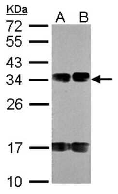 Western Blot: FUS2 Antibody [NBP1-30978] - Sample (30 ug of whole cell lysate) A: A431 B: H1299 12% SDS PAGE; antibody diluted at 1:1000.