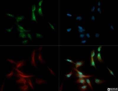Immunocytochemistry/Immunofluorescence: FUSIP1 Antibody [NB110-93598] - FUSIP1 antibody was tested in Hela cells with DyLight 488 (green). Nuclei and alpha-tubulin were counterstained with DAPI (blue) and Dylight 550 (red).