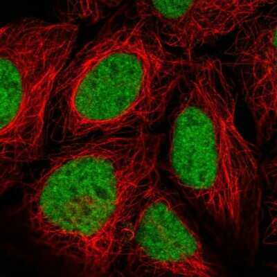 Immunocytochemistry/ Immunofluorescence FUSIP1 Antibody