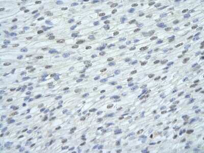 Immunohistochemistry: FUSIP1 Antibody [NBP1-57428] - Paraffin Embedded Tissue: Human Heart cell Cellular Data: cardiac cell of renal tubule Antibody Concentration: 4.0 - 8.0 ug/ml Magnification: 400X