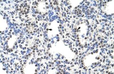 Immunohistochemistry: FUSIP1 Antibody [NBP1-57428] - Paraffin Embedded Tissue: Human Lung Cellular Data: Alveolar cells Antibody Concentration: 4.0 - 8.0 ug/ml Magnification: 400