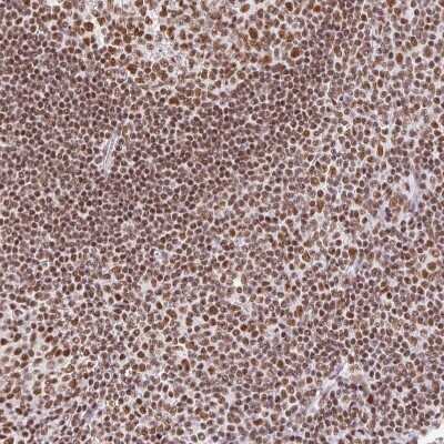 Immunohistochemistry: FUSIP1 Antibody [NBP2-46818] - Staining of human tonsil shows moderate to strong nuclear positivity in non-germinal center cells.