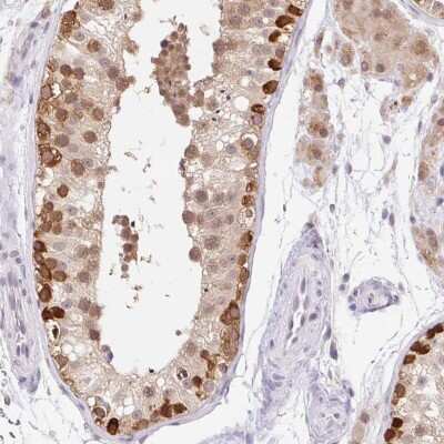 Immunohistochemistry-Paraffin: FUSIP1 Antibody [NBP2-46815] - Staining of human testis shows strong nuclear positivity in subset of cells in seminiferous ducts.