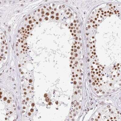 Immunohistochemistry-Paraffin FUSIP1 Antibody