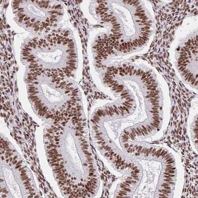 Immunohistochemistry-Paraffin FUSIP1 Antibody