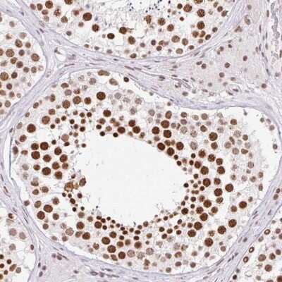 Immunohistochemistry-Paraffin: FUSIP1 Antibody [NBP2-46818] - Staining of human testis shows moderate to strong nuclear positivity in cells in seminiferous ducts.