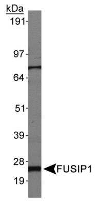 Western Blot: FUSIP1 Antibody [NB110-93598] - Detection of FUSIP1, Isoform 3, in HepG2 whole cell lysates using NB110-93598.