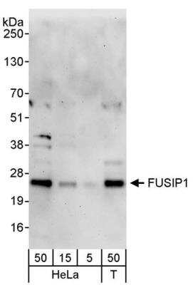 Western Blot: FUSIP1 Antibody [NB110-93598] - Detection of human FUSIP1 by western blot. Samples: Whole cell lysate from HeLa (5, 15 and 50 ug) and HEK293T (T; 50 ug) cells. Antibody: Affinity purified rabbit anti-FUSIP1 antibody NB110-93598 used for WB at 0.4 ug/ml. Detection: Chemiluminescence with an exposure time of 3 minutes.