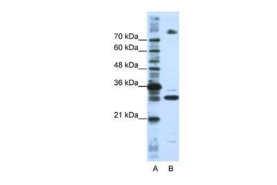 Western Blot: FUSIP1 Antibody [NBP1-57428] - Reccomended Titration: 0.2 - 1 ug/ml Positive Control: HepG2 cell lysate FUSIP1 is supported by BioGPS gene expression data to be expressed in HepG2