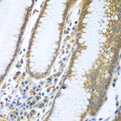 Immunohistochemistry-Paraffin FUT6 Antibody - BSA Free