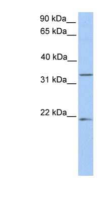 Western Blot: FUT6 Antibody [NBP1-57936] - Hela cell lysate, concentration 0.2-1 ug/ml.