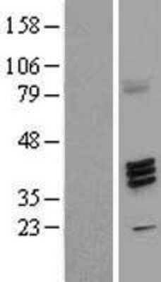 Western Blot Fucosyltransferase 7/FUT7 Overexpression Lysate