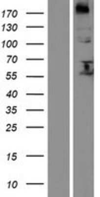 Western Blot: FUT8 Overexpression Lysate (Adult Normal) [NBP2-04985] Left-Empty vector transfected control cell lysate (HEK293 cell lysate); Right -Over-expression Lysate for FUT8.