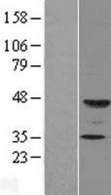 Western Blot FUT9 Overexpression Lysate
