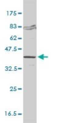Western Blot FVT1 Antibody (2B2-3C11) - Azide and BSA Free