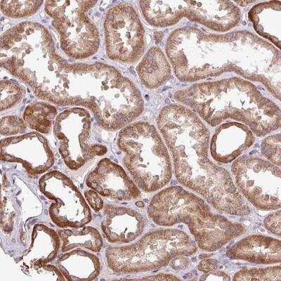 Immunohistochemistry-Paraffin: FXC1 Antibody [NBP2-14031] - Staining of human kidney shows strong cytoplasmic positivity in cells in tubules.