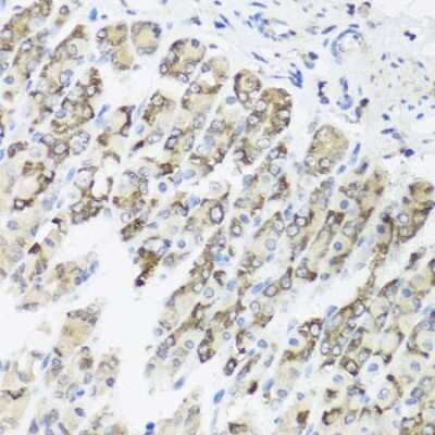Immunohistochemistry-Paraffin: FXC1 Antibody [NBP3-03225] - Paraffin-embedded mouse stomach using FxC1 antibody at dilution of 1:100 (40x lens).