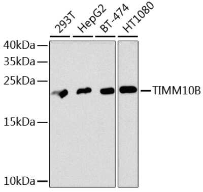 Immunohistochemistry-Paraffin: FXC1 Antibody [NBP3-03225] - Analysis of extracts of various cell lines, using FxC1 antibody at 1:1000 dilution. Secondary antibody: HRP Goat Anti-Rabbit IgG (H+L) at 1:10000 dilution. Lysates/proteins: 25ug per lane. Blocking buffer: 3% nonfat dry milk in TBST. Detection: ECL Basic Kit.