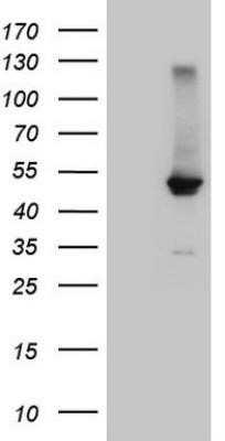 Western Blot: FXR/NR1H4 Antibody (OTI4F12) - Azide and BSA Free [NBP2-71526] - HEK293T cells were transfected with the pCMV6-ENTRY control (Left lane) or pCMV6-ENTRY NR1H4 (RC217443, Right lane) cDNA for 48 hrs and lysed. Equivalent amounts of cell lysates (5 ug per lane) were separated by SDS-PAGE and immunoblotted with anti-NR1H4